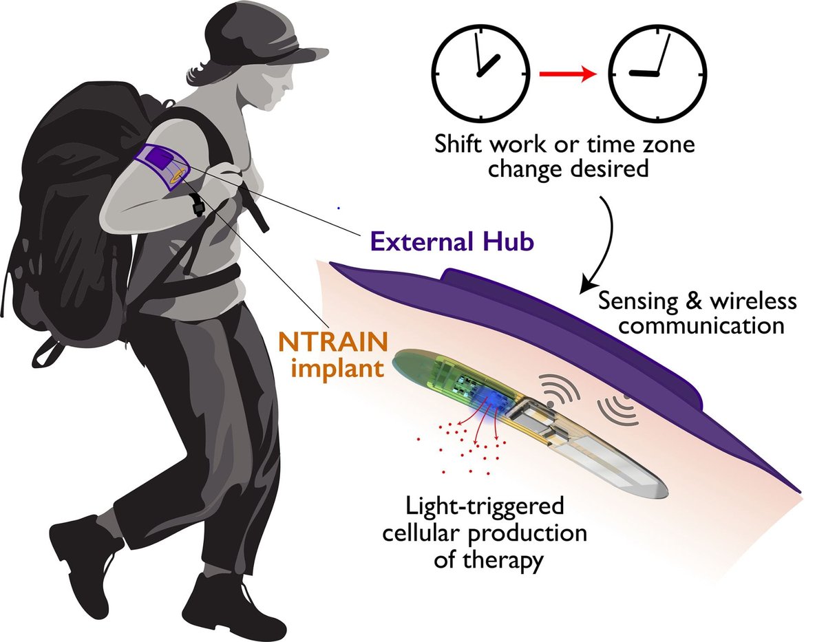 ntrain jet lag cure implant