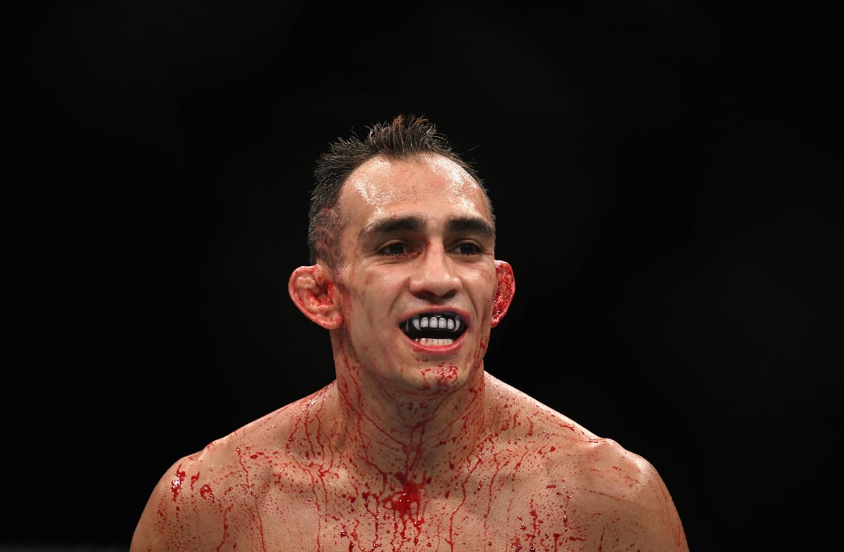 I Hate To Say It (Again), But Tony Ferguson Needs To Retire