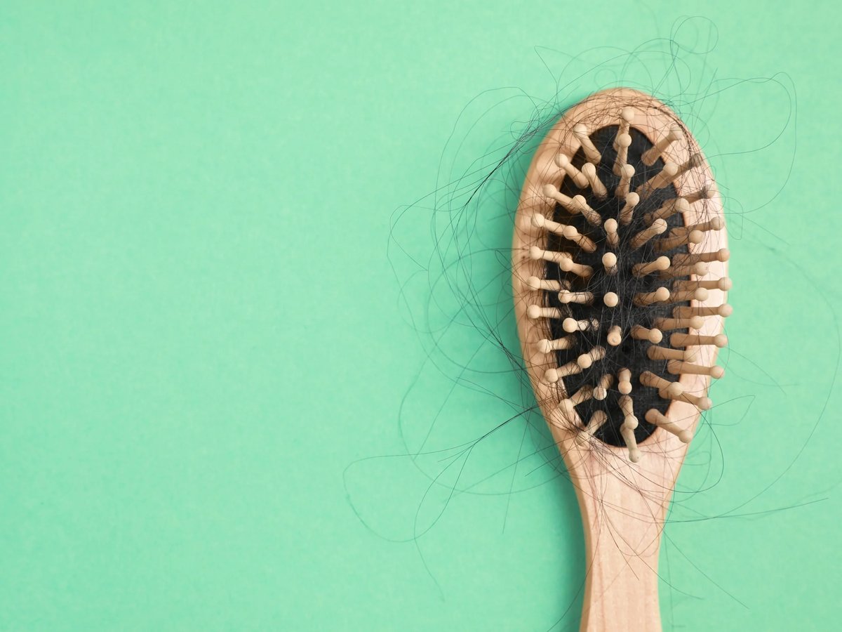 Hair Shedding, Hair Loss